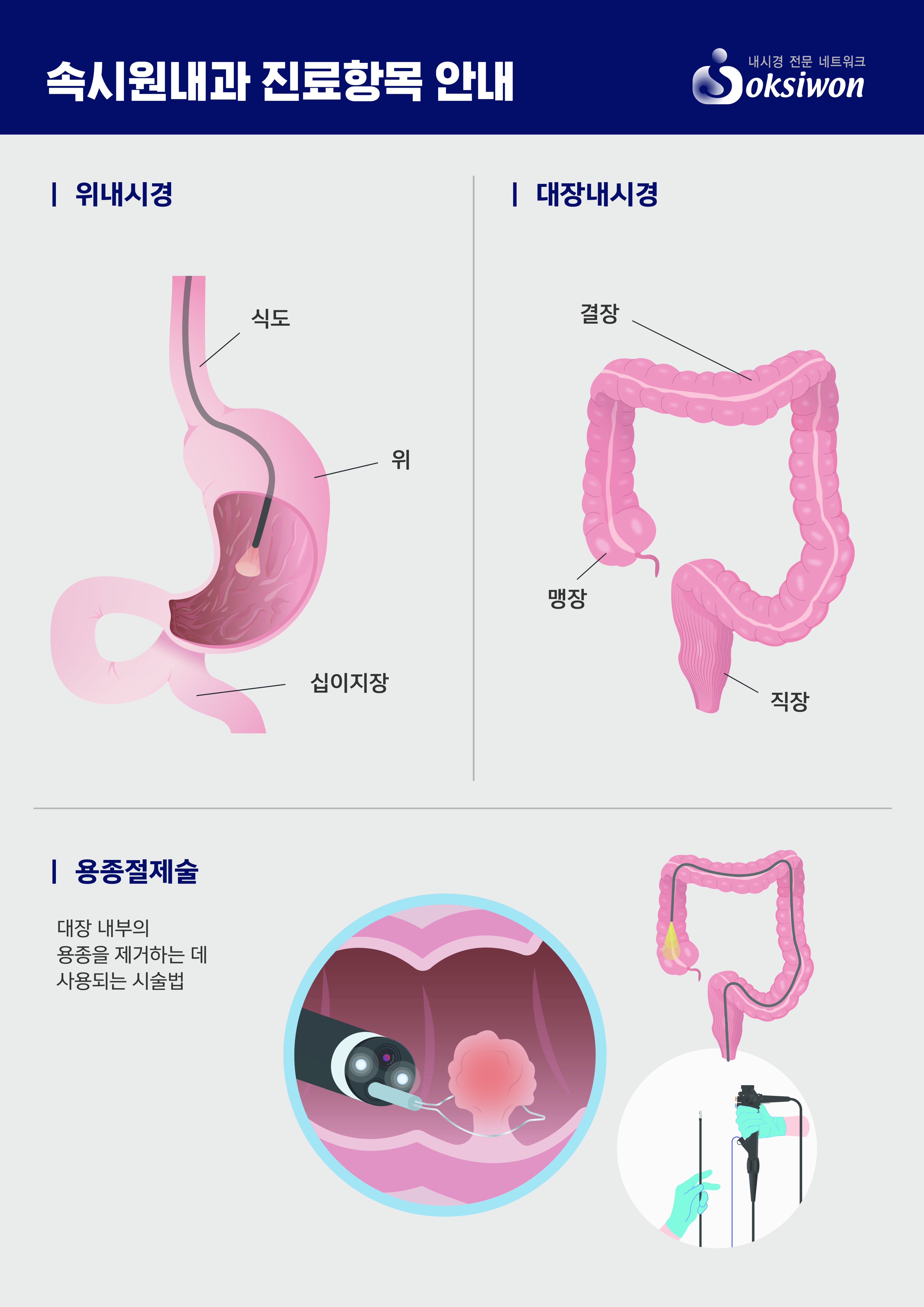 231207_구미인동속시원내과_원내제작물_01.jpg